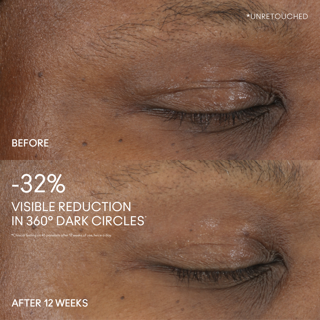 Hyper Real Serumizer™ Eye 360° Bright Eye Treatment | Fresh Routine Favorite